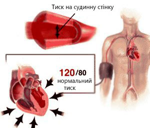 попередження гіпертонії